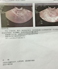 "孕40天,难道杭州各大医院都要去看过吗?"