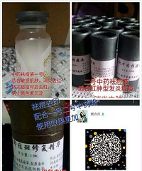 "分享去痘印最有效的方法 教你怎么祛痘"