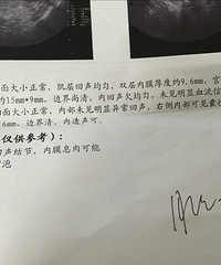 "去测卵泡,结果说我内膜息肉可能,这样还会怀孕吗?好迷茫。。。