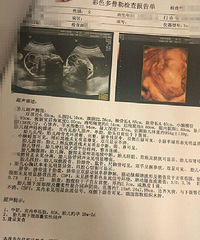 " 四维彩超畸形儿好伤心。。。"