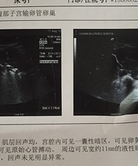 一个冒充准妈妈在论坛里偷拳头的准爸爸~