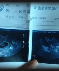 "【孕妈日记】意外的羊宝宝让我初尝当妈的感动"
