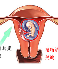 "黄体功能不全的症状 寻医问药寻病症"