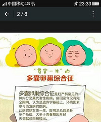 "【艳子与您分享】多囊卵巢综合症的图解\n "