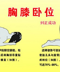 "孕晚期胎位不正怎么办 医疗技术发展不要过度担心"