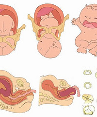 "顺产好还是剖腹产好 各有优点特殊情况下选择剖腹产"