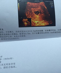 "绝对正能量,60天迎来胎心胎芽,不看你会后悔的!"