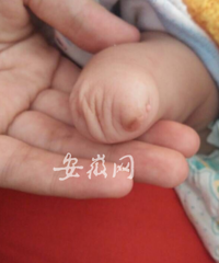 "产检做7次B超没查出孩子缺脚 庐江两家医院推脱责任"