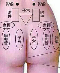 "臀部不仅有肉,还有毒素、激素和经络\n\n臀"