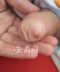 "9次产检7次B超却没查出孩子没右脚!产检不能完全排畸"