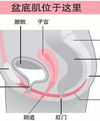 "杭州盆底肌修复 请选择LA LUNA国际产后修复中心-产后盆底肌康复