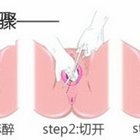 "我的神奇顺产日记不侧切不缝针附方法 护士都惊呆了"