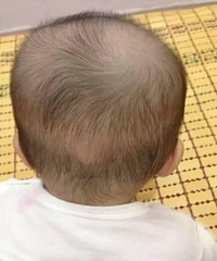 "2岁宝宝的头颅竟奇怪发生变形,90%家长不会注意这细节"
