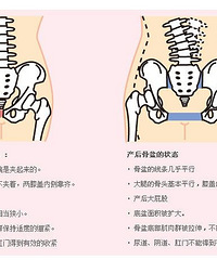 "杭州产后瘦身减肥,产后瘦身,做一个健康自信的辣妈!"