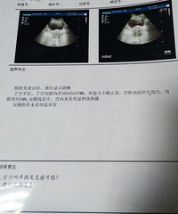 "求助:请哪位医生贴友帮我看看,我到底是怎么回事..."