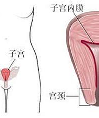 "子宫内膜厚度与不孕不育的关系"