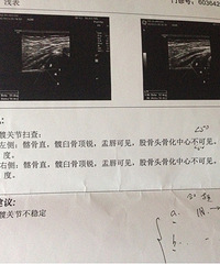 "宝宝一个月体检的时候医生把他两腿分开往下"