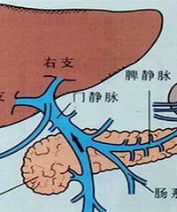 妊娠期急性脂肪肝,危害有多大?