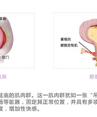 "杭州产后盆底康复治疗"