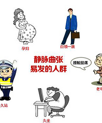 什么是静脉曲张?有哪些类?