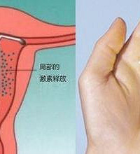 取环后注意事项有哪些?必须知道这六点