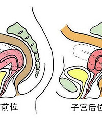 "子宫后位如何受孕?改变性交姿势有帮助!"