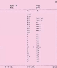 "人人都做尿常规 你知道如何收集尿液吗?"