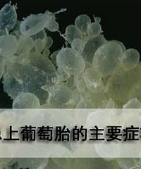 葡萄胎早期症状?及早发现按时诊治