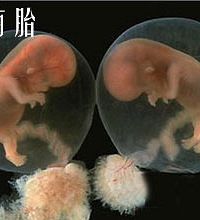 葡萄胎治疗 多久后可以尝试再孕?