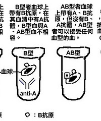 "血型检查方法 注意事项也要看"