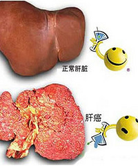 测甲胎蛋白应对措施 了解原因对症下药