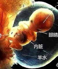 "孕妇大笑致羊水破裂 面对羊水早破你要了解哪些?"