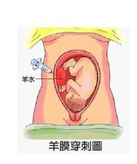 "羊水穿刺什么时候最佳?不易刺伤胎儿"