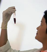 HIV抗体检测方法有哪些?如何检测HIV