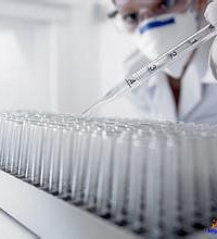 "HIV抗体检测数据解读 教您看HIV检测单"