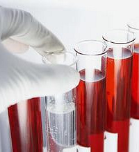 HIV抗体检测方法有哪些?如何检测HIV