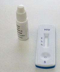 HIV抗体检测数据解读 检验单怎么看?