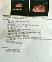 "今天可把我激动死了,我的宝宝复活了"