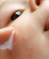 宝宝过敏性皮炎,妈妈们应该了解的自测方法
