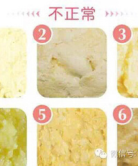 "多图慎入!便便有9种颜色,只有3种是健康的(附健康九色卡)"