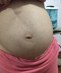 "肚子越长越歪是怎么回事"