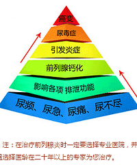 " 前列腺失守,性福止步!"