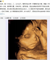 "47岁伊能静或因高龄早产 二胎宝宝四维图曝光"