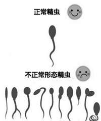 弱精症是什么,怎么治疗
