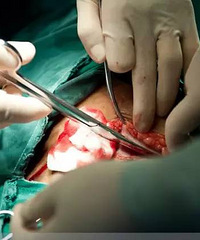 "剖腹产全过程照片,男士们有勇气看完吗?(二)"