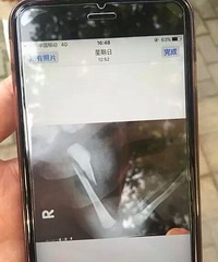 ����ŮӤסԺ����� ������ô���£�