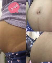孕16周,肚子大我孕16周,出门人家都说