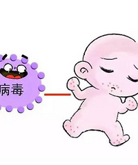 "宝宝过敏护理大全"