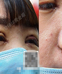 杭州老板娘劝店里女员工集体去整容!整完后悲剧了…