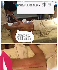 "时下的火爆的“产后修身”真的有用吗?!19楼有位妈妈去试了!"